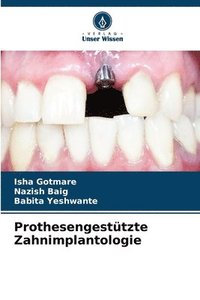bokomslag Prothesengesttzte Zahnimplantologie