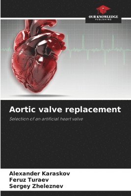 bokomslag Aortic valve replacement