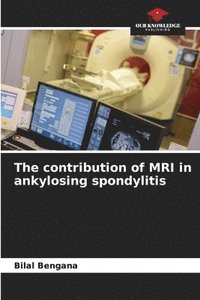 bokomslag The contribution of MRI in ankylosing spondylitis