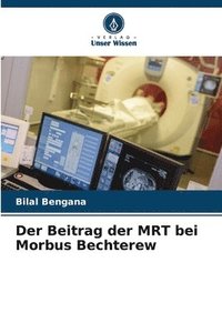 bokomslag Der Beitrag der MRT bei Morbus Bechterew