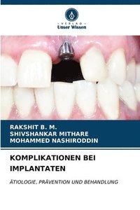 bokomslag Komplikationen Bei Implantaten