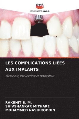 bokomslag Les Complications Lies Aux Implants