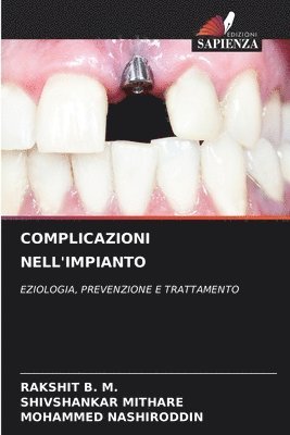 bokomslag Complicazioni Nell'impianto