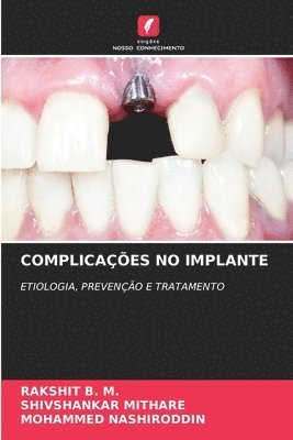 Complicaes No Implante 1