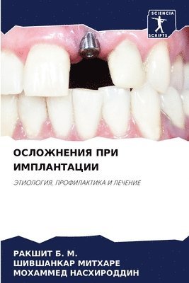 bokomslag &#1054;&#1057;&#1051;&#1054;&#1046;&#1053;&#1045;&#1053;&#1048;&#1071; &#1055;&#1056;&#1048; &#1048;&#1052;&#1055;&#1051;&#1040;&#1053;&#1058;&#1040;&#1062;&#1048;&#1048;