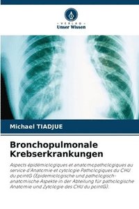 bokomslag Bronchopulmonale Krebserkrankungen