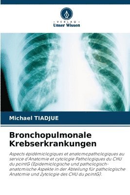 Bronchopulmonale Krebserkrankungen 1