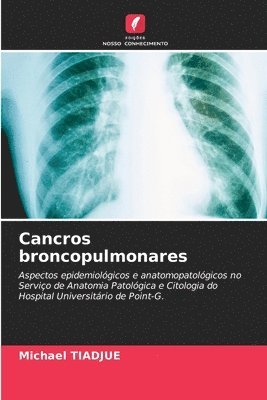 bokomslag Cancros broncopulmonares