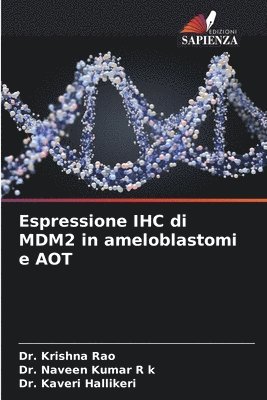 Espressione IHC di MDM2 in ameloblastomi e AOT 1