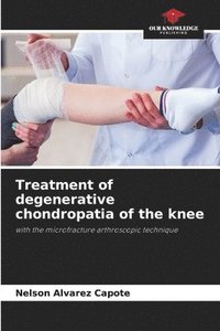 bokomslag Treatment of degenerative chondropatia of the knee