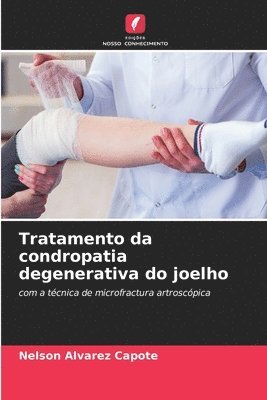 Tratamento da condropatia degenerativa do joelho 1