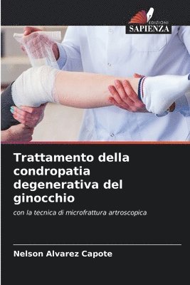 bokomslag Trattamento della condropatia degenerativa del ginocchio