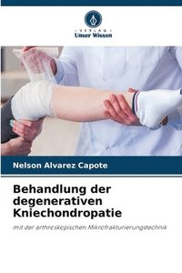 bokomslag Behandlung der degenerativen Kniechondropatie