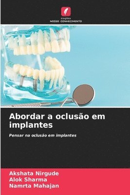 Abordar a ocluso em implantes 1