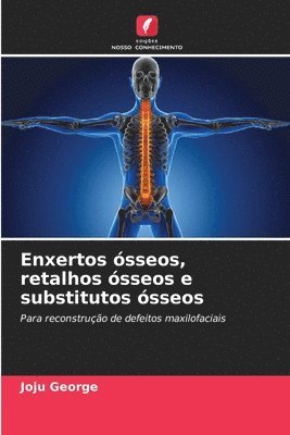 bokomslag Enxertos sseos, retalhos sseos e substitutos sseos