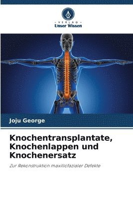 Knochentransplantate, Knochenlappen und Knochenersatz 1