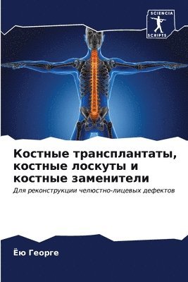 bokomslag &#1050;&#1086;&#1089;&#1090;&#1085;&#1099;&#1077; &#1090;&#1088;&#1072;&#1085;&#1089;&#1087;&#1083;&#1072;&#1085;&#1090;&#1072;&#1090;&#1099;, &#1082;&#1086;&#1089;&#1090;&#1085;&#1099;&#1077;