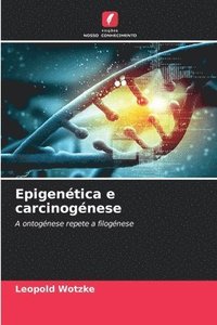 bokomslag Epigentica e carcinognese