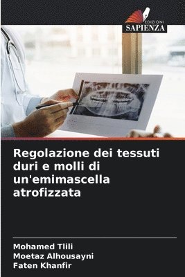 bokomslag Regolazione dei tessuti duri e molli di un'emimascella atrofizzata