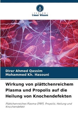 bokomslag Wirkung von plttchenreichem Plasma und Propolis auf die Heilung von Knochendefekten