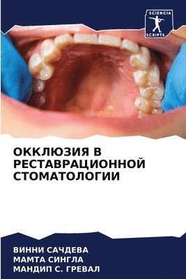 &#1054;&#1050;&#1050;&#1051;&#1070;&#1047;&#1048;&#1071; &#1042; &#1056;&#1045;&#1057;&#1058;&#1040;&#1042;&#1056;&#1040;&#1062;&#1048;&#1054;&#1053;&#1053;&#1054;&#1049; 1