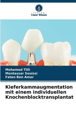 Kieferkammaugmentation mit einem individuellen Knochenblocktransplantat 1