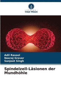 bokomslag Spindelzell-Lsionen der Mundhhle