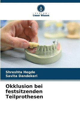 bokomslag Okklusion bei festsitzenden Teilprothesen