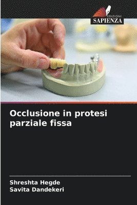 bokomslag Occlusione in protesi parziale fissa