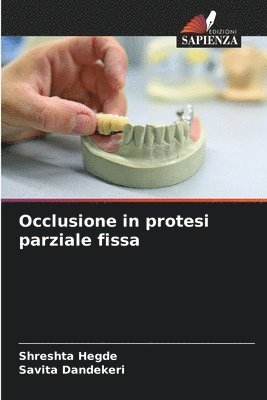 Occlusione in protesi parziale fissa 1