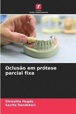 bokomslag Ocluso em prtese parcial fixa