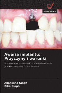 bokomslag Awaria implantu: Przyczyny i warunki