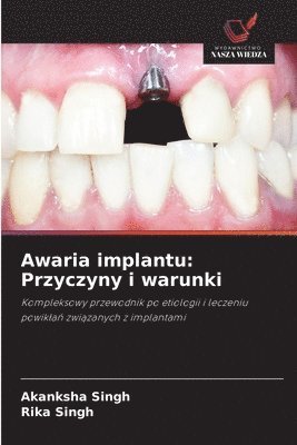 bokomslag Awaria implantu: Przyczyny i warunki