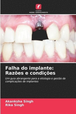 Akanksha Singh, Rika Singh - Falha do implante, Häftad