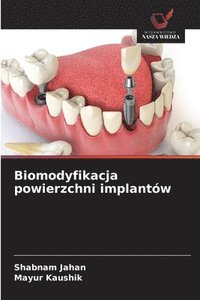 bokomslag Biomodyfikacja powierzchni implantów