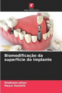 bokomslag Biomodificação da superfície do implante