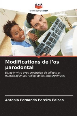 bokomslag Modifications de l'os parodontal