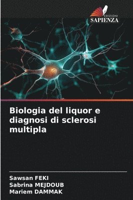 Biologia del liquor e diagnosi di sclerosi multipla 1