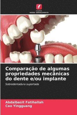 bokomslag Comparao de algumas propriedades mecnicas do dente e/ou implante