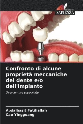 bokomslag Confronto di alcune propriet meccaniche del dente e/o dell'impianto