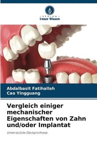 bokomslag Vergleich einiger mechanischer Eigenschaften von Zahn und/oder Implantat