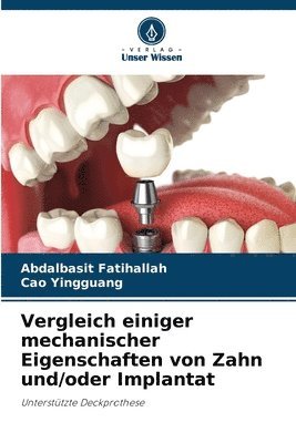 Vergleich einiger mechanischer Eigenschaften von Zahn und/oder Implantat 1