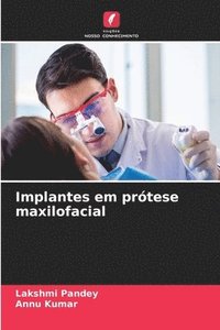 bokomslag Implantes em prtese maxilofacial