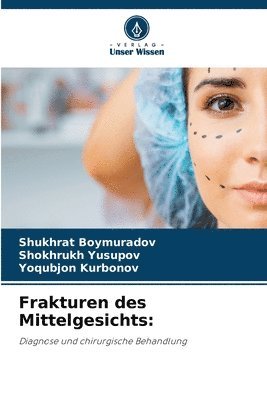 bokomslag Frakturen des Mittelgesichts