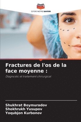 bokomslag Fractures de l'os de la face moyenne