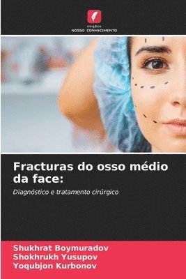 bokomslag Fracturas do osso mdio da face