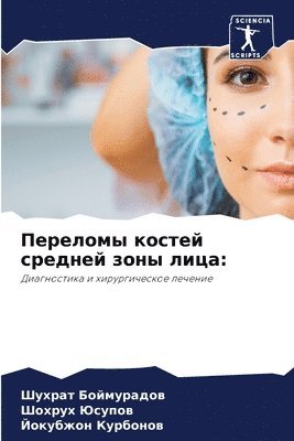 &#1055;&#1077;&#1088;&#1077;&#1083;&#1086;&#1084;&#1099; &#1082;&#1086;&#1089;&#1090;&#1077;&#1081; &#1089;&#1088;&#1077;&#1076;&#1085;&#1077;&#1081; &#1079;&#1086;&#1085;&#1099; 1