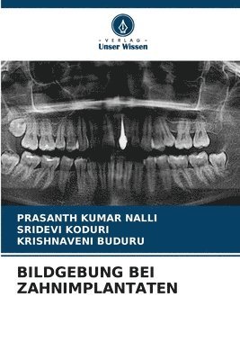 bokomslag Bildgebung Bei Zahnimplantaten