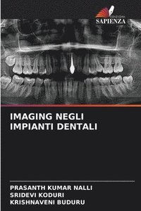 bokomslag Imaging Negli Impianti Dentali