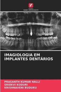 bokomslag Imagiologia Em Implantes Dentrios